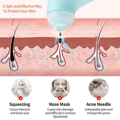 0288 Vacuum Blackhead Machine Reduce Spot Mini Handheld Lifting Massage Facial Blackhead Remover