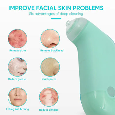 0288 Vacuum Blackhead Machine Reduce Spot Mini Handheld Lifting Massage Facial Blackhead Remover